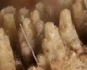 [photo of compound pedicels]