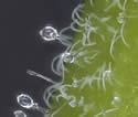 [photo of hairs on upper stem]