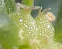 [close-up of glomerule]